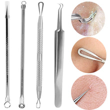 Load image into Gallery viewer, Pimple Blackhead Remover Stainless Steel Acne Removal Needles
