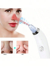 Load image into Gallery viewer, Electric Suction Blackheads
