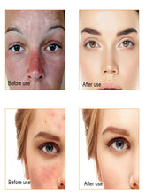 Load image into Gallery viewer, Vitamin C Serum For Face Moisturizing Brightens Skin
