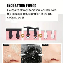 Load image into Gallery viewer, 50/100PCS Bamboo Charcoal Nasal Strips Blackhead Remover M
